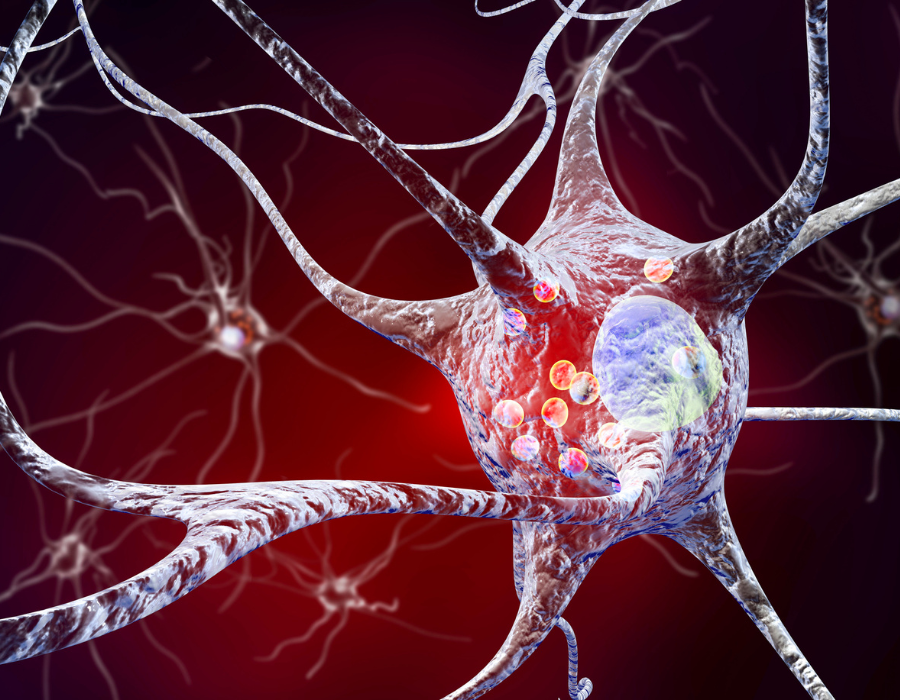 Guia para Aposentados e Pensionistas com Parkinson: Como Obter Isenção do Imposto de Renda